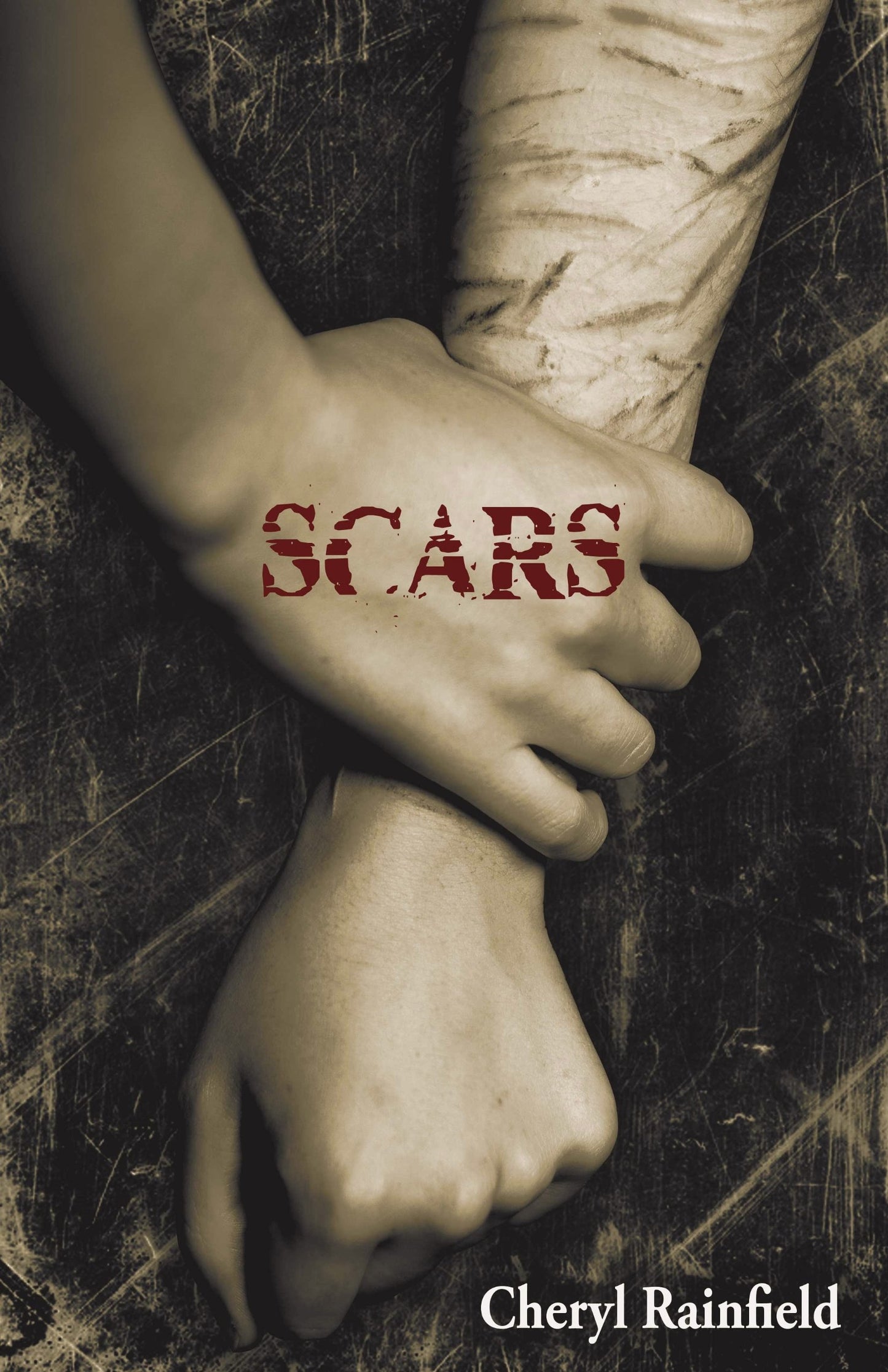 Scars